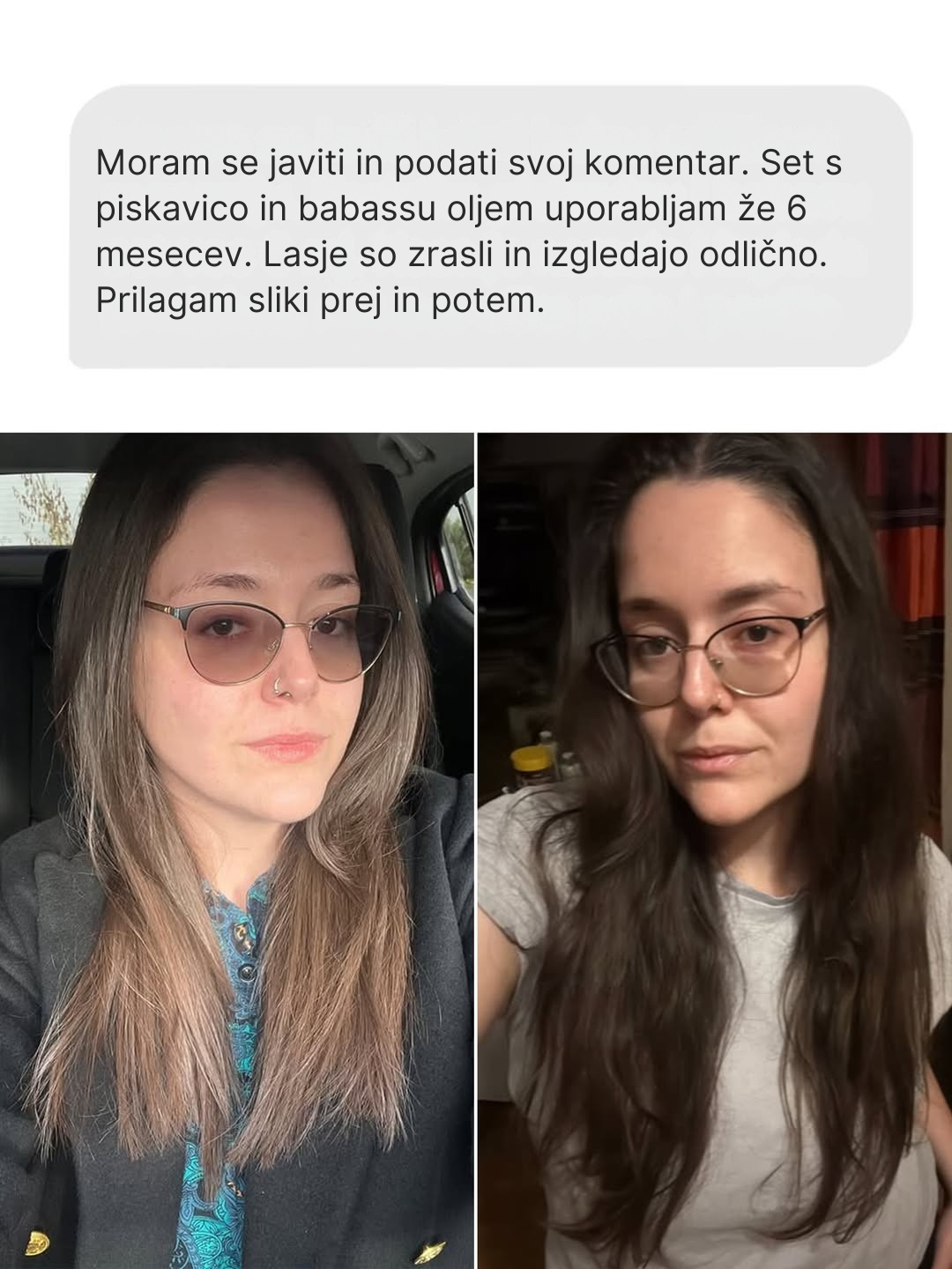 Moram se javiti in podati svoj komentar. Set s piskavico in babassu oljem uporabljam že 6 mesecev. Lasje so zrasli in izgledajo odlično. Prilagam sliki prej in potem.